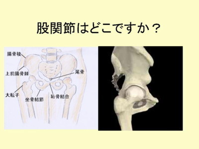 股関節3.jpg