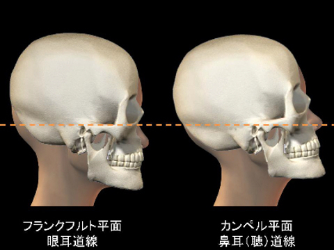 カンペル(1).jpg